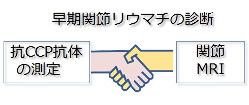 早期関節リウマチの診断