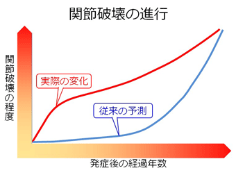 関節破壊の進行